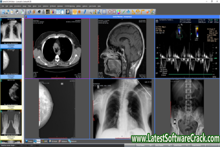 Sante DICOM Editor 8.1.5 Free Download