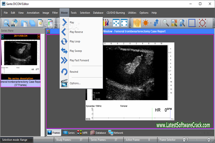 Sante DICOM Editor 8.1.5 Free Download