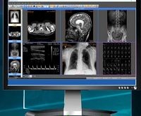 Sante PACS Server 3.0.5 Free Download