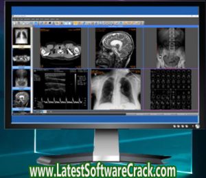 Sante DICOM Editor 8.1.5 Free Download