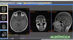 Sante DICOM Viewer Pro 12.1.5 Free Download