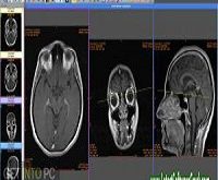 Sante DICOM Viewer Pro 12.1.5 Free Download