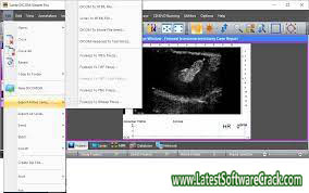 Sante DICOM Viewer Pro 12.1.5 Free Download