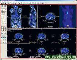Sante PACS Server PG 3.1.4 Free Download