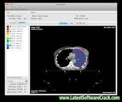 Sante PACS Server PG 3.1.4 Free Download
