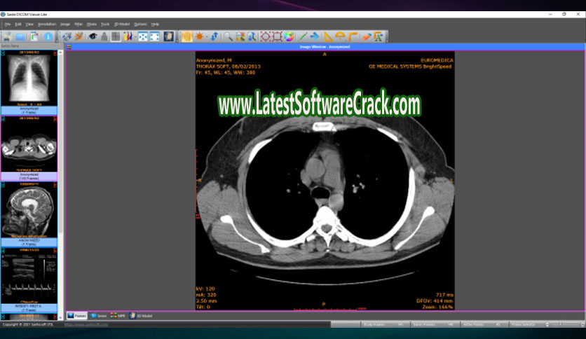 Sante PACS Server PG 3.1.4 Free Download